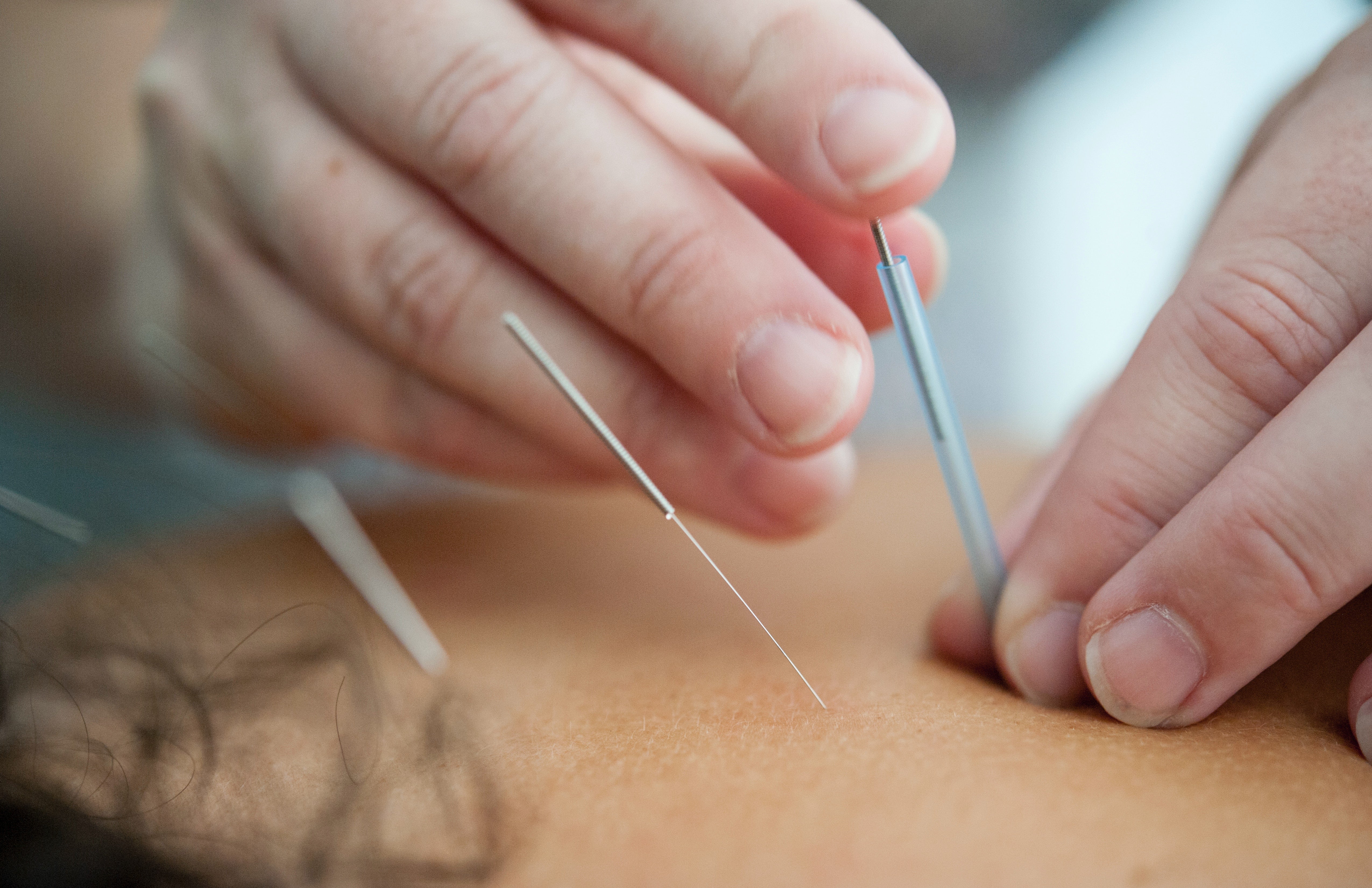 Can acupuncture help my fertility? We asked our CEO to break down the benefits.